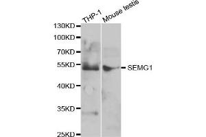 Western Blotting (WB) image for anti-Semenogelin I (SEMG1) antibody (ABIN1876675) (SEMG1 Antikörper)