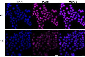 anti-Bromodomain Adjacent To Zinc Finger Domain, 1B (BAZ1B) antibody