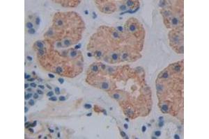 Used in DAB staining on fromalin fixed paraffin- embedded Kidney tissue (ADAP2 Antikörper  (AA 49-361))