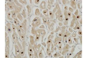 Immunoperoxidase of monoclonal antibody to TTN on formalin-fixed paraffin-embedded human heart. (Titin Antikörper  (AA 1-110))