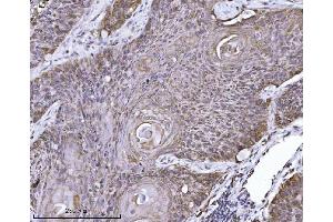IHC analysis of ERLIN2 using anti-ERLIN2 antibody (ABIN7602582).