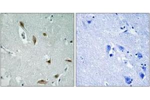 Immunohistochemistry analysis of paraffin-embedded human brain, using AKT1/3 (Phospho-Tyr437/434) Antibody. (AKT1/3 (AA 406-455), (pTyr437) Antikörper)