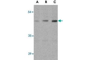 Western blot analysis of ANTXR1 in HepG2 cell lysates with ANTXR1 polyclonal antibody  at (A) 0. (ANTXR1 Antikörper  (Internal Region))