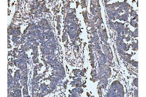 IHC analysis of LARP1 using anti-LARP1 antibody (ABIN7599861). (LARP1 Antikörper  (AA 123-401))