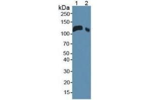 Rabbit Detection antibody from the kit in WB with Positive Control:  Sample Sample: Lane1: Mouse Serum; Lane2: Mouse Placenta Tissue. (LIFR ELISA Kit)