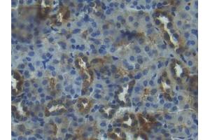 DAB staining on IHC-P; Samples: Mouse Kidney Tissue (IGFBP3 Antikörper  (AA 152-292))