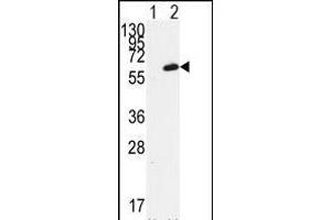 Western blot analysis of FGR (arrow) using FGR Antibody (N-term) (ABIN392096 and ABIN2841848). (Fgr Antikörper  (N-Term))