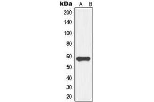 Western blot analysis of GDF9 expression in HL60 (A) whole cell lysates.