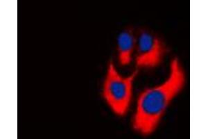 Immunofluorescent analysis of CKMT2 staining in THP1 cells. (CKMT2 Antikörper  (Center))