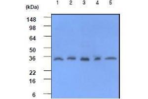 Western Blotting (WB) image for anti-C-Reactive Protein (CRP) (AA 19-224) antibody (ABIN317507) (CRP Antikörper  (AA 19-224))