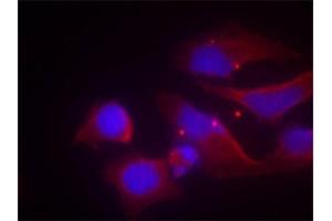 Immunofluorescence staining of methanol-fixed Hela cells using Phospho-GRIN2B-Y1474 antibody. (GRIN2B Antikörper  (pTyr1474))