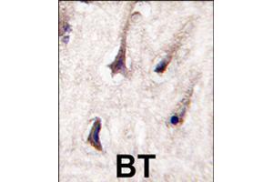 Formalin-fixed and paraffin-embedded human brain tissue reacted with PRKCB polyclonal antibody  , which was peroxidase-conjugated to the secondary antibody, followed by DAB staining . (PKC beta Antikörper  (C-Term))