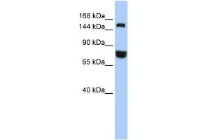 WB Suggested Anti-EEA1 Antibody Titration: 0. (EEA1 Antikörper  (Middle Region))