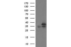 HEK293T cells were transfected with the pCMV6-ENTRY control (Left lane) or pCMV6-ENTRY CDK2 (Right lane) cDNA for 48 hrs and lysed. (CDK2 Antikörper)