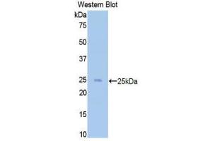 Western Blotting (WB) image for anti-CD40 Ligand (CD40LG) (AA 48-244) antibody (ABIN3209276) (CD40 Ligand Antikörper  (AA 48-244))
