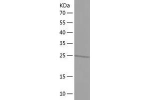 Western Blotting (WB) image for Transcription Factor AP-4 (Activating Enhancer Binding Protein 4) (TFAP4) (AA 148-338) protein (His tag) (ABIN7283980) (TFAP4 Protein (AA 148-338) (His tag))