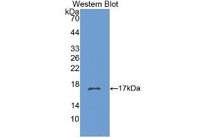 Western Blotting (WB) image for anti-Cholinergic Receptor, Nicotinic, beta 3 (Neuronal) (CHRNB3) (AA 119-230) antibody (ABIN1867233)