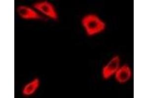 Immunofluorescent analysis of RhoC staining in Hela cells.