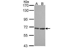 WB Image Sample (30 ug of whole cell lysate) A: Hela B: JurKat 7. (SH3BP1 Antikörper  (C-Term))