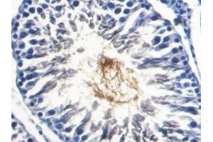 DAB staining on IHC-P; Samples: Rat Testis Tissue (SPA17 Antikörper  (AA 1-140))