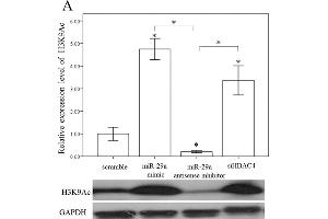 Western Blotting (WB) image for anti-Glyceraldehyde-3-Phosphate Dehydrogenase (GAPDH) antibody (ABIN2857072)