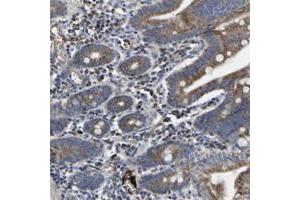 Immunohistochemical staining of human small intestine with CCDC90B polyclonal antibody  shows moderate cytoplasmic positivity at 1:20-1:50 dilution. (CCDC90B Antikörper)