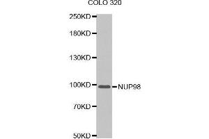 Western blot analysis of extracts of COLO 320 cells tissue, using NUP98 antibody. (NUP98 Antikörper  (AA 621-920))