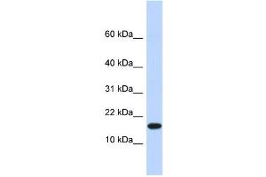 WB Suggested Anti-EGLN2 Antibody Titration:  0. (PHD1 Antikörper  (N-Term))