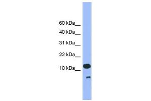 WB Suggested Anti-CDC26 Antibody Titration: 0. (CDC26 Antikörper  (C-Term))