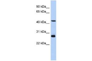 WB Suggested Anti-SYT9 Antibody Titration: 0. (SYT9 Antikörper  (Middle Region))