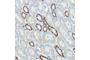 Immunohistochemistry of paraffin-embedded mouse kidney using IP6K1 Rabbit pAb (ABIN6131922, ABIN6142500, ABIN6142501 and ABIN6215821) at dilution of 1:100 (40x lens). (IP6K1 Antikörper  (AA 1-220))