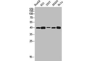 Western blot analysis of HEPG2 823 293T AD293 HELA using SR-1D antibody. (5HT1D Antikörper  (Internal Region))