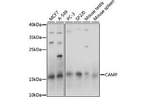 Western blot analysis of extracts of various cell lines, using CAMP antibody (ABIN7266146) at 1:1000 dilution. (Cathelicidin Antikörper  (AA 31-170))