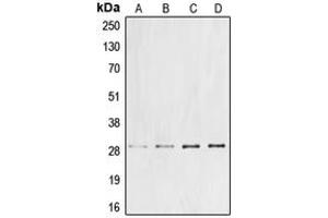 Western blot analysis of Cyclin G1 expression in DLD (A), Jurkat (B), mouse liver (C), rat liver (D) whole cell lysates. (Cyclin G1 Antikörper  (Center))