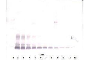 Image no. 3 for anti-PDGF-BB Homodimer antibody (ABIN465589) (PDGF-BB Homodimer Antikörper)