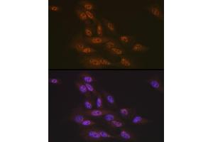 Immunofluorescence analysis of U-2 OS cells using Transportin 3 (Transportin 3 (TNPO3)) Rabbit mAb (ABIN7270971) at dilution of 1:100 (40x lens). (Transportin 3 Antikörper)