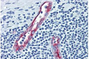 Human Tonsil (formalin-fixed, paraffin-embedded) stained with SELP antibody ABIN462342 followed by biotinylated anti-mouse IgG secondary antibody ABIN481714, alkaline phosphatase-streptavidin and chromogen. (P-Selectin Antikörper)