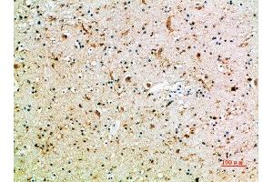 Immunohistochemical analysis of paraffin-embedded human-brain, antibody was diluted at 1:200 (CD16a, CD16b (AA 100-150) Antikörper)