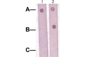 Dot Blot : 1 ug peptide was blot onto NC membrane. (SOX9 Antikörper  (Ser181))