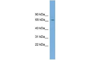 WB Suggested Anti-SNAG1 Antibody Titration: 0. (SNX18 Antikörper  (C-Term))