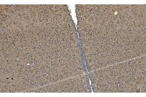 IHC analysis of FABP-1/GOT2 using anti-FABP-1/GOT2 antibody (ABIN7601426). (GOT2 Antikörper  (AA 35-430))