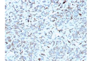 Formalin-fixed, paraffin-embedded human Kidney stained with C1QA Mouse Monoclonal Antibody (C1QA/2952). (C1QA Antikörper  (AA 104-237))