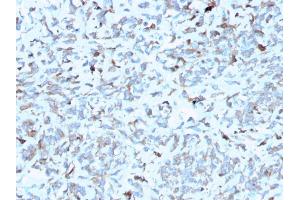 Immunohistochemistry (IHC) image for anti-Complement Component 1, Q Subcomponent, A Chain (C1QA) (AA 104-237) antibody (ABIN6940765)