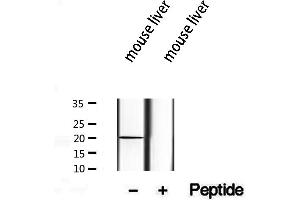 Western blot analysis of extracts from mouse liver, using TIMM17B antibody. (TIMM17B Antikörper  (Internal Region))