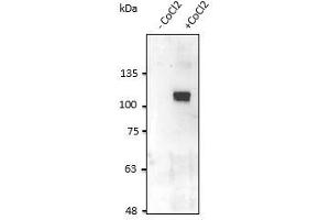 Anti-HIF1α Ab at 2,500 dilution, HT1080 cells in the presence of COCl lysate at 100 µg per Iane, rabbit polyclonal to goat lgG (HRP) at 1/10,000 dilution, (HIF1A Antikörper  (C-Term))
