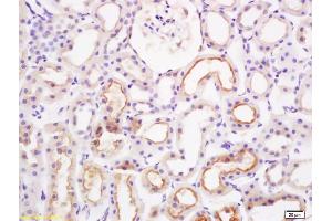 Formalin-fixed and paraffin embedded rat kidney labeled with Rabbit Anti PAI-1 Polyclonal Antibody, Unconjugated (ABIN733223) at 1:200 followed by conjugation to the secondary antibody and DAB staining (PAI1 Antikörper  (AA 301-402))