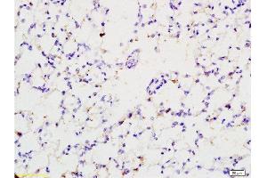 Formalin-fixed and paraffin embedded rat lung tissue labeled with Anti-EPOR Polyclonal Antibody , Unconjugated at 1:200 followed by conjugation to the secondary antibody and DAB staining (EPOR Antikörper  (AA 301-450))
