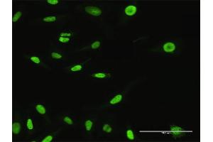 Immunofluorescence of purified MaxPab antibody to XPO5 on HeLa cell.