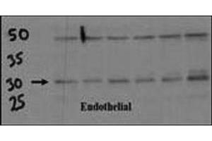 Endothelial cell lysate transferred to membrane was incubated with DSCR1 antibody at a 1:500 dilution. (RCAN1 Antikörper  (AA 222-252))