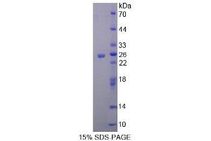 SDS-PAGE (SDS) image for Metaxin 1 (MTX1) (AA 163-324) protein (His tag) (ABIN6239008)